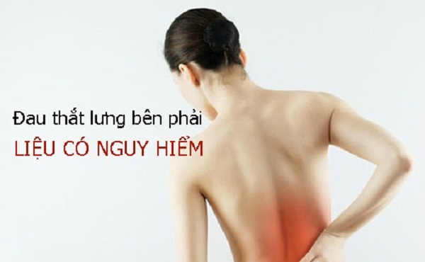 Đau thắt lưng bên phải là bệnh gì?