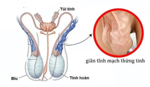 Đau tinh hoàn một bên: Dấu hiệu đáng báo động