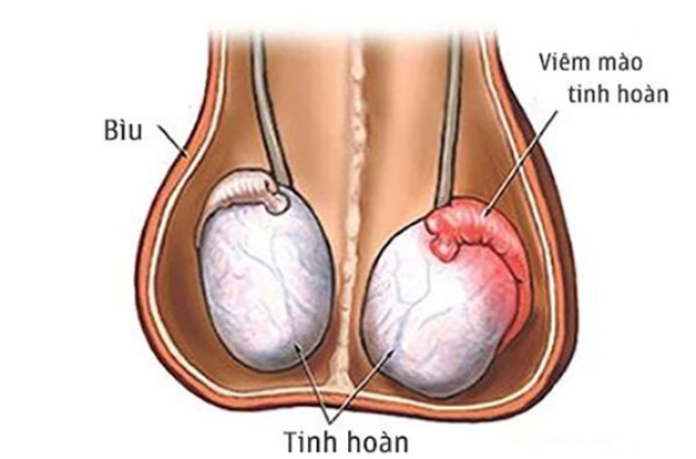 Đau tinh hoàn một bên: Dấu hiệu đáng báo động