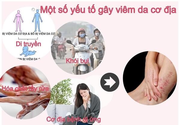 Đề phòng viêm da cơ địa khi thời tiết hanh khô