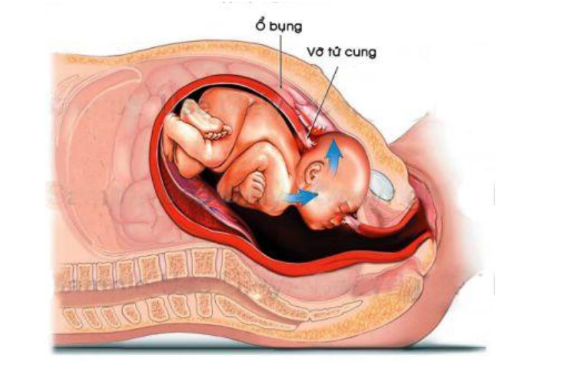 Đẻ thường lần 3 và những lưu ý dành cho mẹ bầu