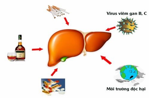 Dị ứng cảnh báo nguy cơ suy giảm chức năng gan