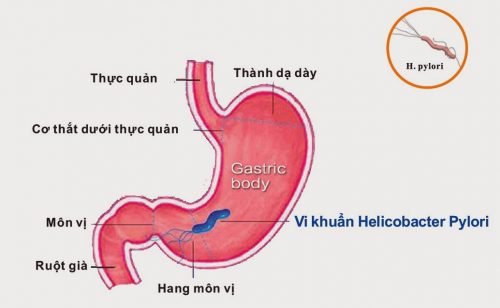 Địa chỉ khám viêm thực quản ở Hà Nội