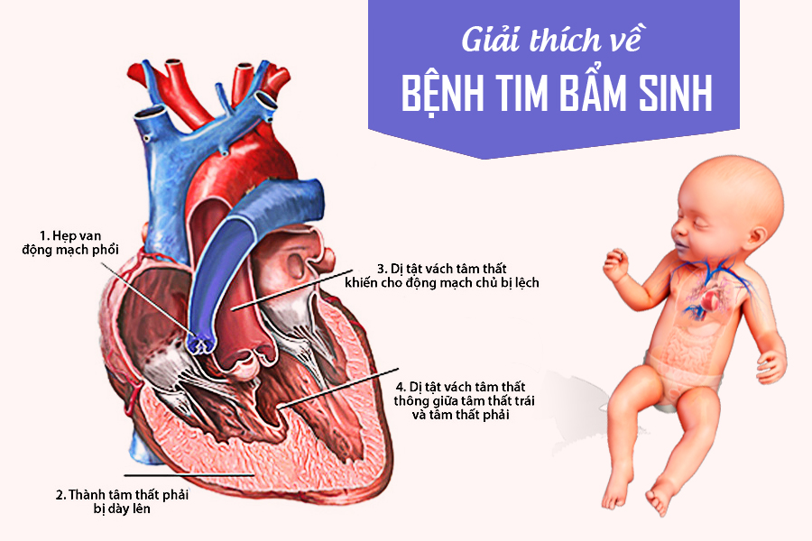 Điểm danh 3 mốc khám sàng lọc thai nhi quan trọng