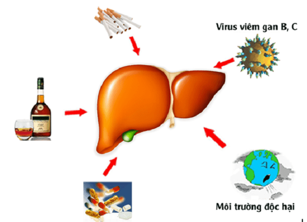 Điểm danh 4 nguyên nhân gây bệnh gan và các phương pháp