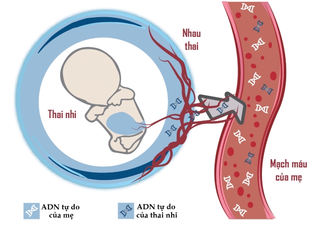 Điểm danh một số loại xét nghiệm tầm soát dị tật thai nhi