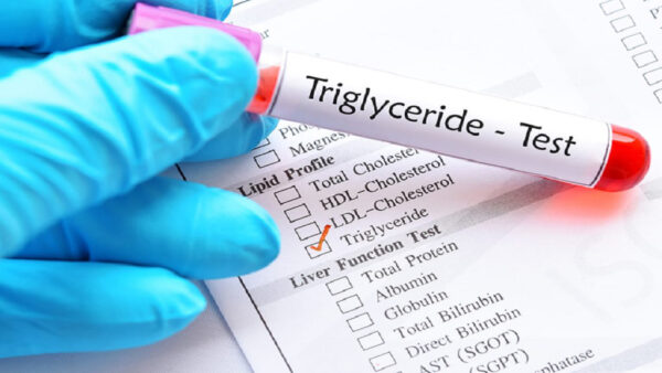 Điều trị viêm tụy cấp tăng triglyceride bằng phương pháp nào?