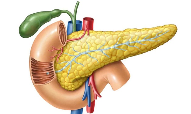 Điều trị viêm tụy cấp thế nào để đạt hiệu quả?