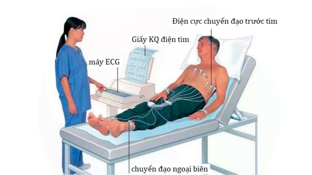 Đo điện tâm đồ là gì, thực hiện ra sao?