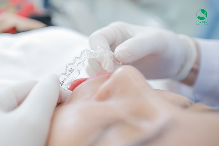 Đón Xuân sang, rạng rỡ nụ cười cùng niềng răng Invisalign