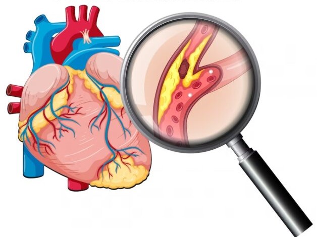 Động mạch vành tim và các bệnh lý liên quan