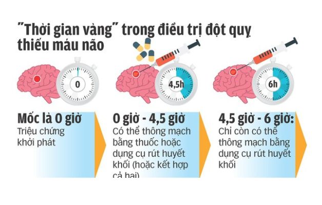 "Thời điểm vàng" khi điều trị đột quỵ