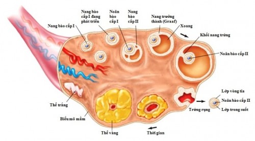 Giá mổ nội soi buồng trứng đa nang là bao nhiêu?