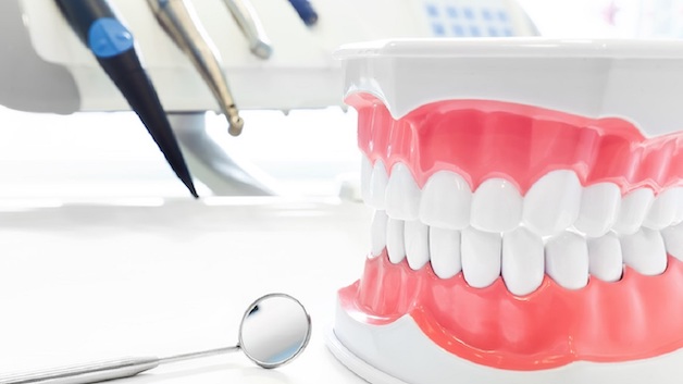 Giá niềng răng Invisalign hiện nay là bao nhiêu? 