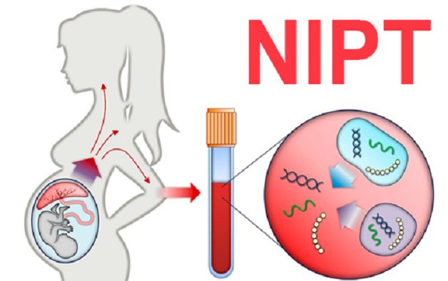 Giải đáp băn khoăn mẹ bầu: Có nên làm xét nghiệm NIPT không?