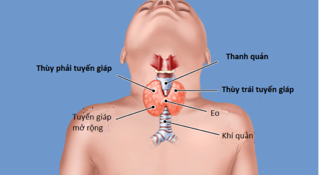 Giải đáp bị tuyến giáp có uống được hà thủ ô không?