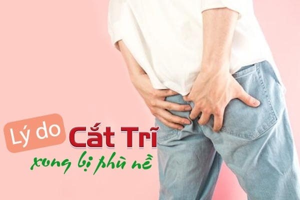 Giải đáp: Cắt trĩ xong bị phù nề thì phải làm gì?