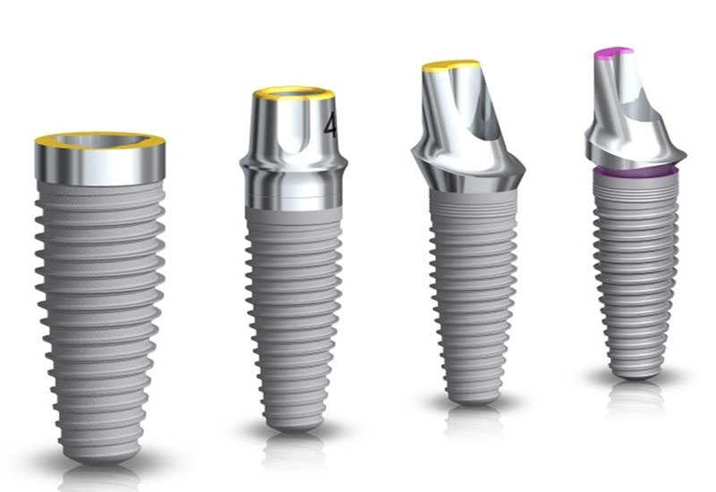 Giải đáp: Cấy ghép răng Implant bao nhiêu tiền