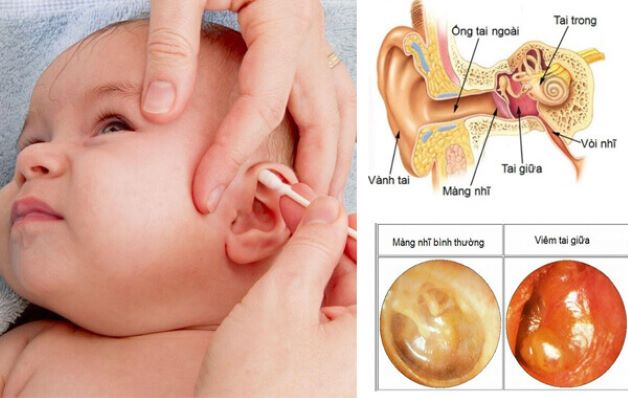 Giải đáp có nên tự điều trị bệnh viêm tai giữa cho trẻ không