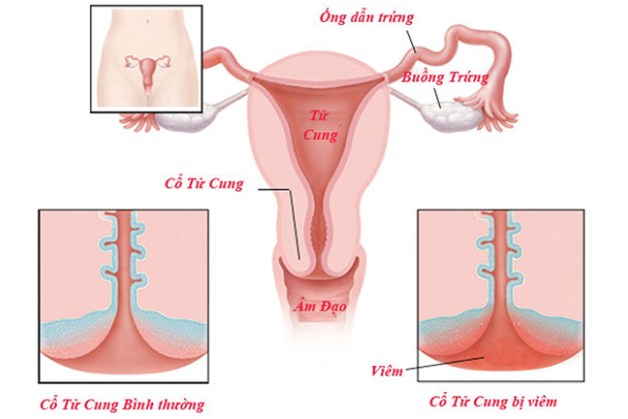 Giải đáp: Đi khám bệnh phụ khoa mất bao nhiêu tiền? 