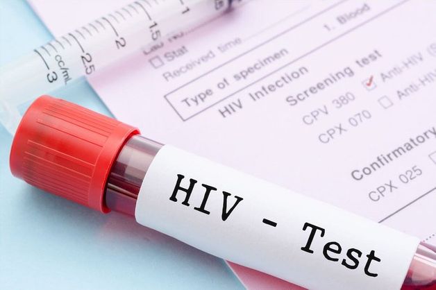 Giải đáp: Khám sức khỏe công ty có xét nghiệm HIV không?