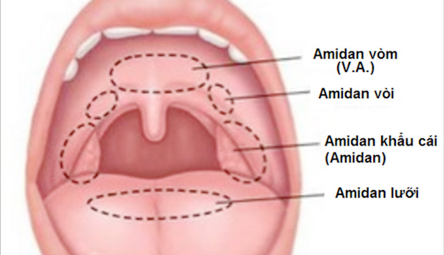 Giải đáp mọi thắc mắc về “trẻ viêm amidan”