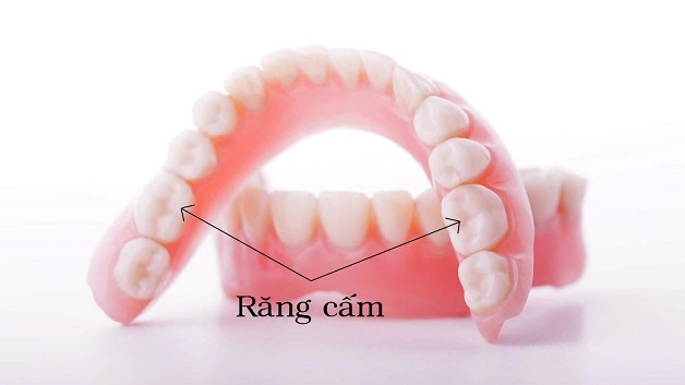 GIẢI ĐÁP: Nhổ răng cấm giá bao nhiêu? 