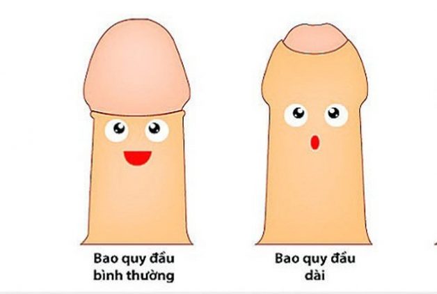 Giải đáp thắc mắc: Cắt dài bao quy đầu bao nhiêu tiền?