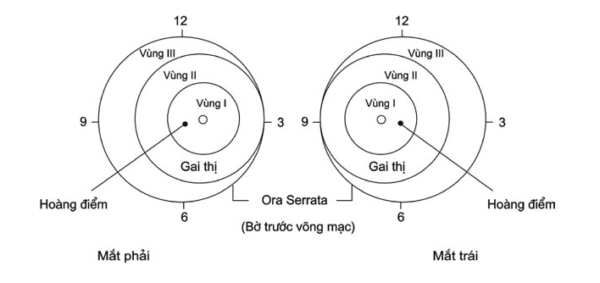 Giải đáp võng mạc non vùng 1 là gì và bệnh võng mạc trẻ sinh non