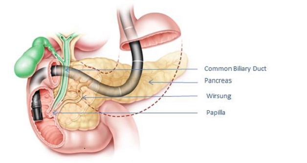 Giúp bạn hiểu rõ về kỹ thuật nội soi mật tụy ngược dòng