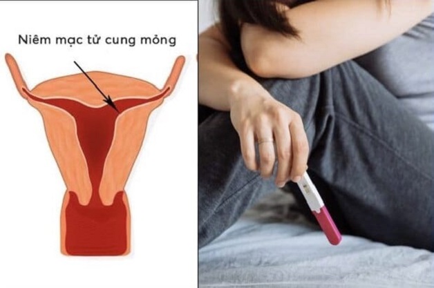 Góc giải đáp cho nữ giới: Niêm mạc tử cung mỏng có sao không?