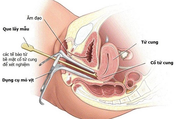 Gói khám bệnh lý phụ khoa có giá bao nhiêu?