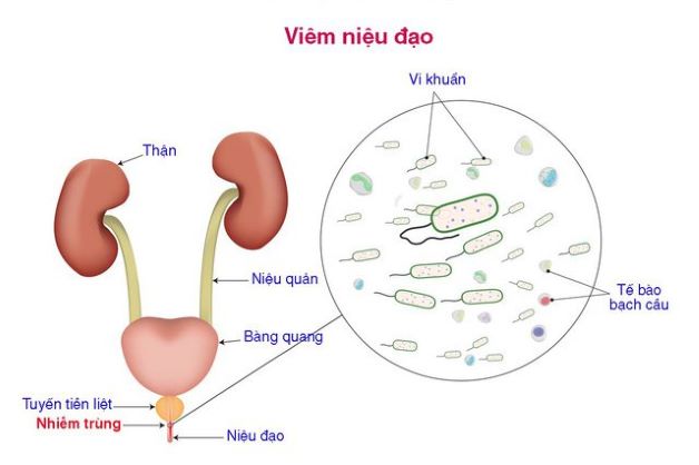 Hiện tượng trẻ hẹp bao quy đầu có nguy hiểm không?