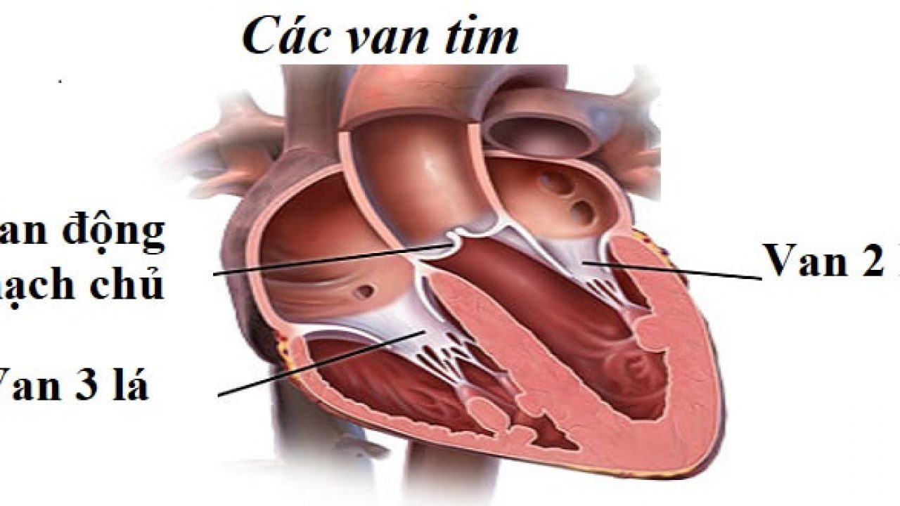 Hở van tim 2 lá khi nào cần phẫu thuật?