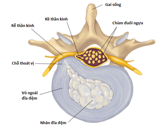 Hội chứng chùm đuôi ngựa: Nguyên nhân, triệu chứng và cách điều trị