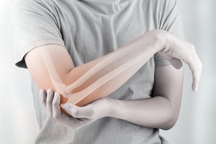 Hội chứng tennis elbow là gì? Nguyên nhân, triệu chứng