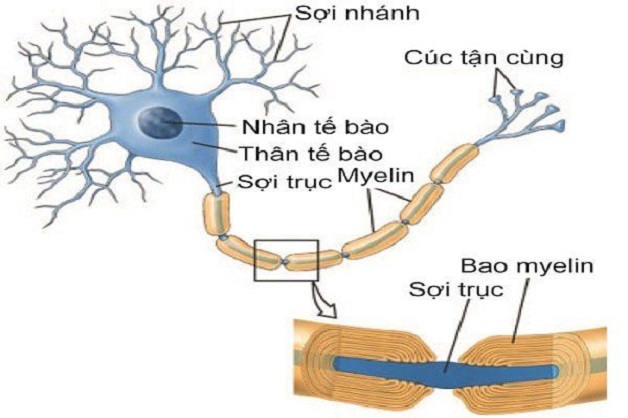 Hội chứng viêm dây thần kinh cấp tính nguyên phát