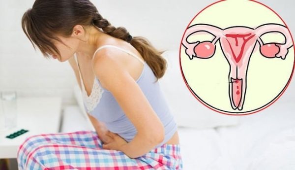 HPV ung thư cổ tử cung: Các giai đoạn bệnh và cách điều trị tương ứng