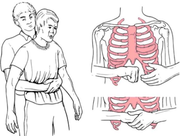 Hướng dẫn cách chữa hóc xương ếch an toàn, hiệu quả