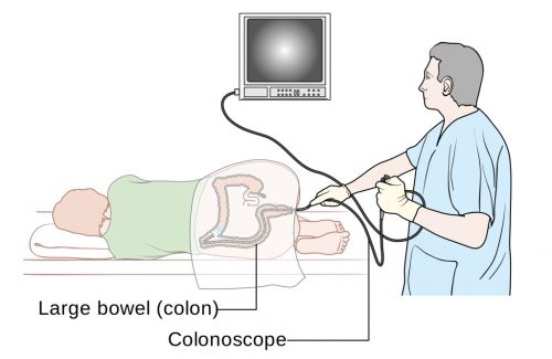 Hướng dẫn nội soi đại tràng