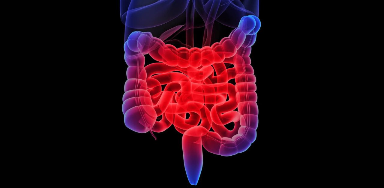 IBD là bệnh gì? Nguyên nhân và cách phòng ngừa