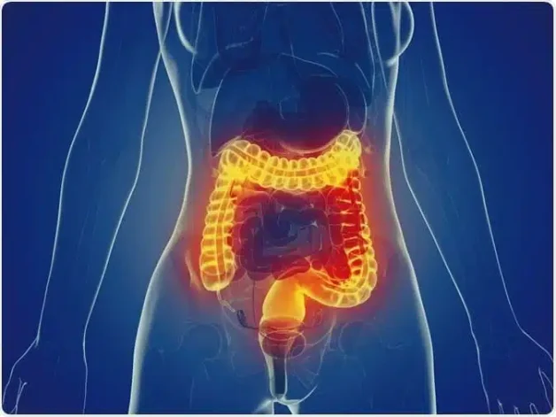 IBD là bệnh gì? Nguyên nhân và cách phòng ngừa