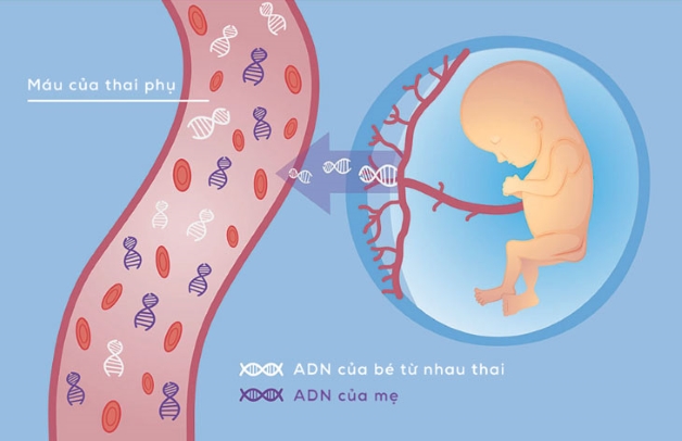 Khám nipt có cần thiết không? Mẹ bầu nên biết