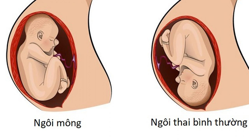 Khám thai tuần 32 sẽ khám những gì?