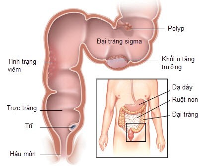 Khám tiêu hóa ở Bệnh viện Thu Cúc