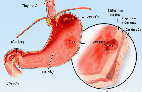 Khám tiêu hóa ở đâu tốt