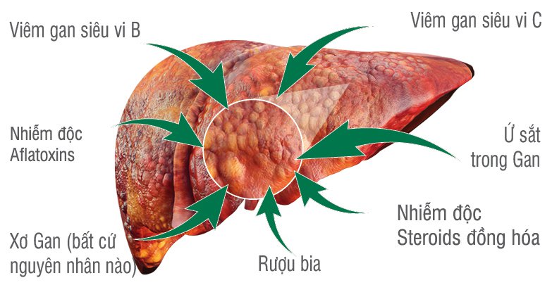 Khám ung thư ở bệnh viện nào kết quả chính xác?