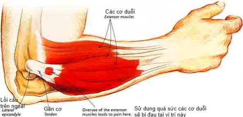 Khám và điều trị viêm đa cơ