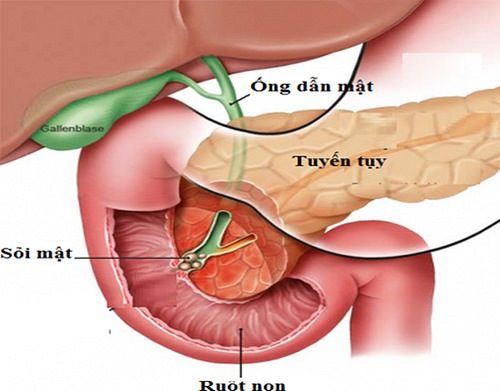 Khám và điều trị viêm tụy