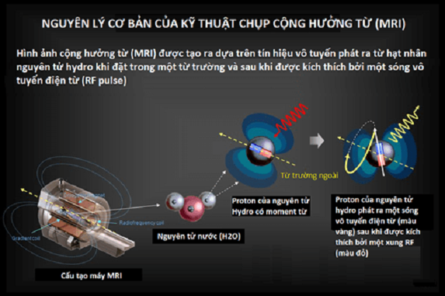 Khi nào nên đến bệnh viện chụp cộng hưởng từ MRI?